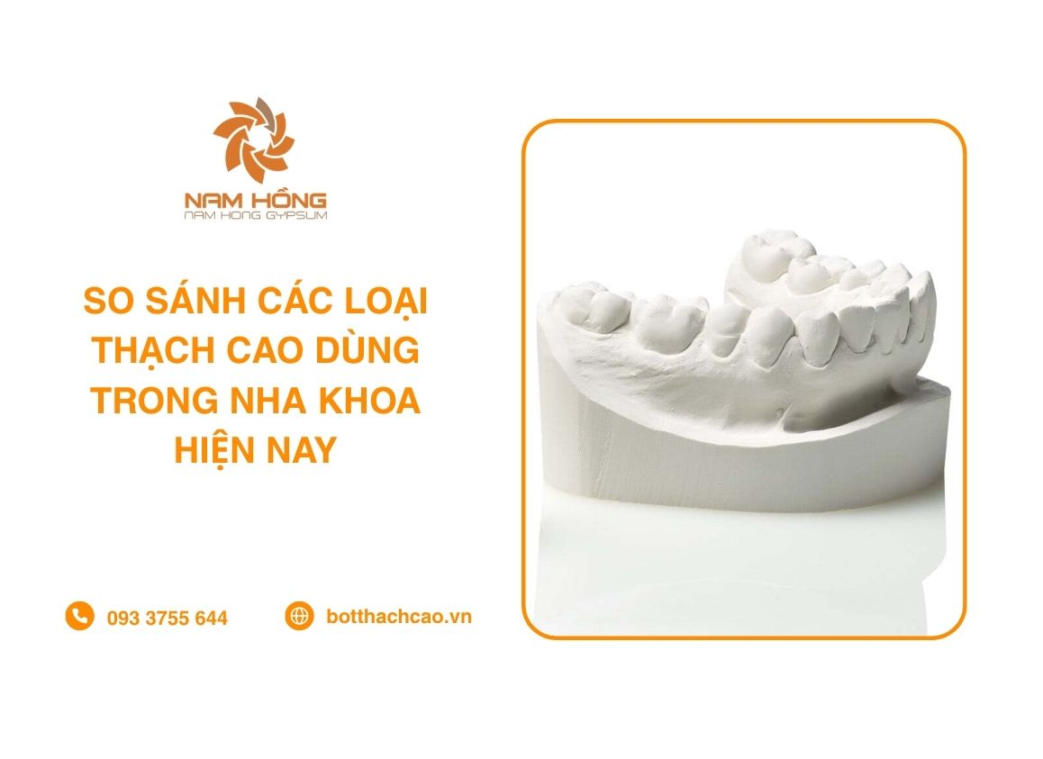 So Sánh Các Loại Thạch Cao Dùng Trong Nha Khoa Hiện Nay