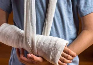 Ứng dụng của bột thạch cao trong chấn thương chỉnh hình xương