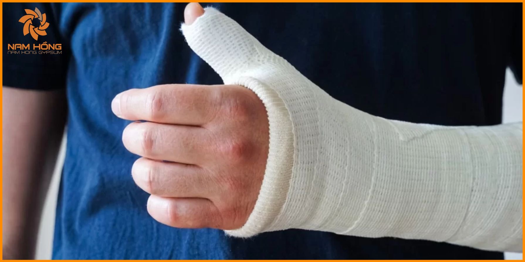 Bột thạch cao y tế là gì?