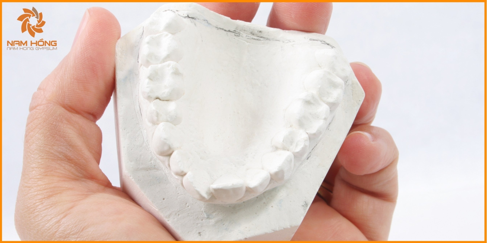 Những lỗi thường gặp khi sử dụng thạch cao trong nha khoa