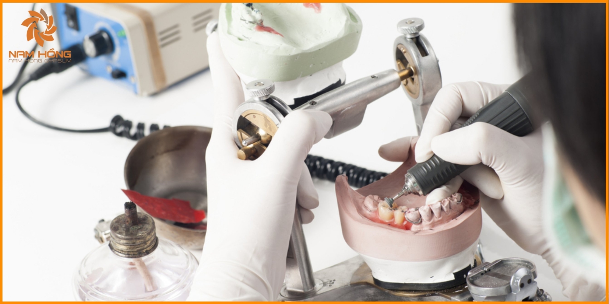 Thạch cao y tế là gì và được sử dụng trong trường hợp nào?